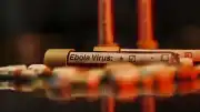 Fransa Sağlık Bakanlığı: Fransa'da ilk Ebola vakası tespit edildi