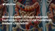 Bilim İnsanları İltihaplı Bağırsak Hastalığını Çip Üzerinde Modellemeyi Başardı