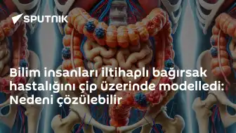 Bilim İnsanları İltihaplı Bağırsak Hastalığını Çip Üzerinde Modellemeyi Başardı