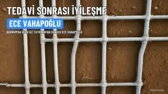 Ece Vahapoğlu kanser tedavisinin ardından Bodrum'da görüntülendi