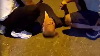 Aydın'da Çıkan Kavgada Bir Kişi Başından Yaralandı