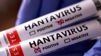 Hantavirüs Endişesi: Arjantin'den Gelen 3 Türk Vatandaşı Karantinaya Alındı