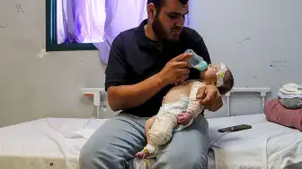İsrail Saldırısında Annesini Kaybeden Bebek Muhammed'in Bacağı Ampute Edildi
