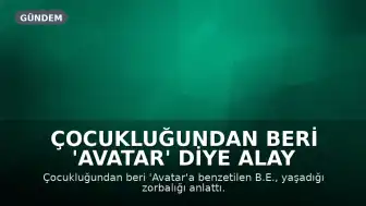 Çocukluğundan Beri 'Avatar' Diye Alay Edilen Kadın: 'Yüzümden Memnunum'