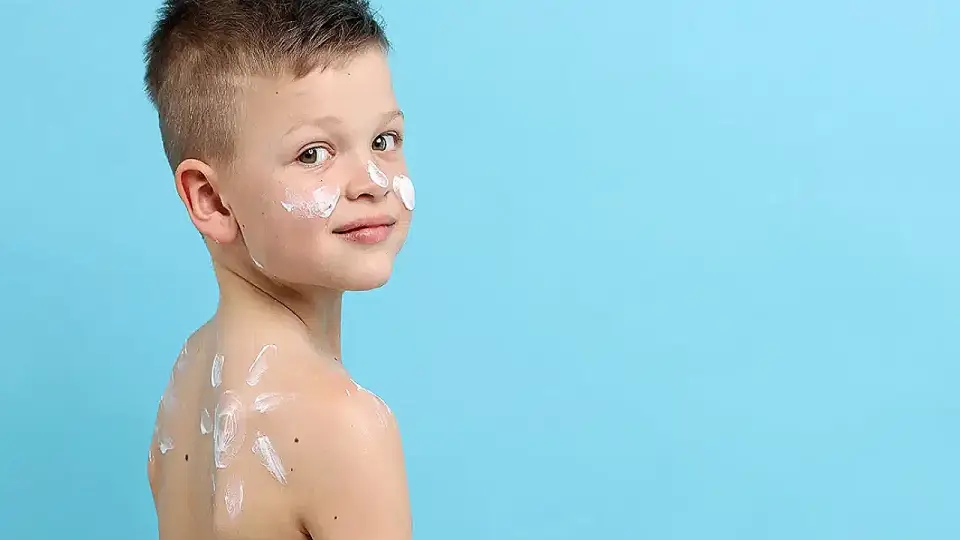 Çocukluk Çağı Güneş Yanıklarının Cilt Kanseri Riskine Etkisi Araştırılıyor