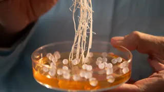 Pitbull Saldırısı Sonrası O.A. Yoğun Bakımda: 'Et Yiyen Bakteri' Şüphesi