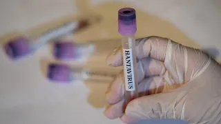 Hantavirüs Tespit Edilen Gemideki 3 Türk Vatandaşı Türkiye'ye Getiriliyor