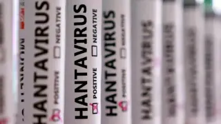 MV Hondius Gemisinde Hantavirüs Salgını: 3 Kişi Hayatını Kaybetti, Kayıp Numuneler Şüpheli